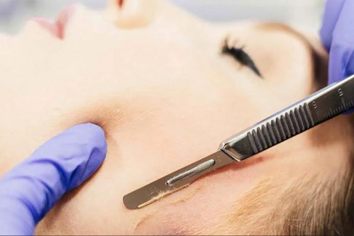 DERMAPLANING GLOW