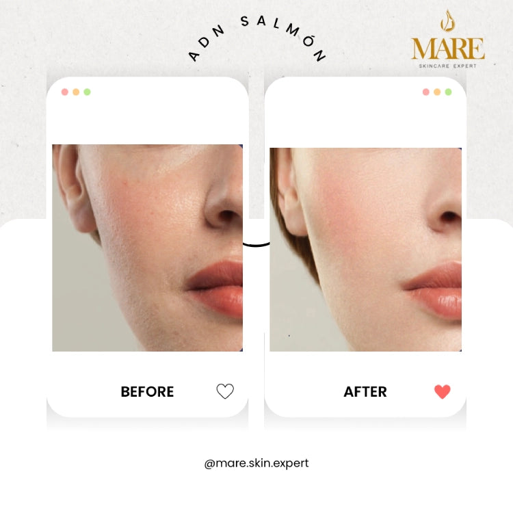 ADN de Salmón – Tratamiento Regenerativo | Mare Perfect Skin