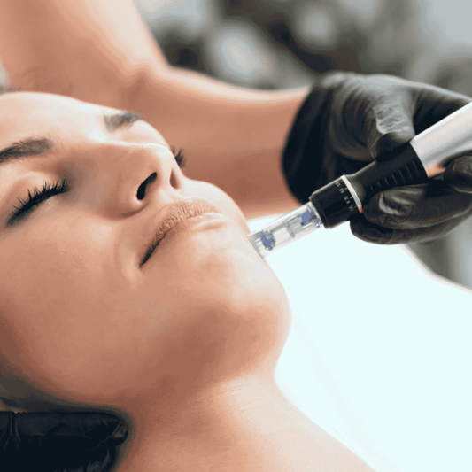 Microneedling
