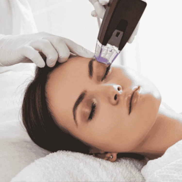 Morpheus8 – Rejuvenecimiento Facial y Corporal | Mare Perfect Skin