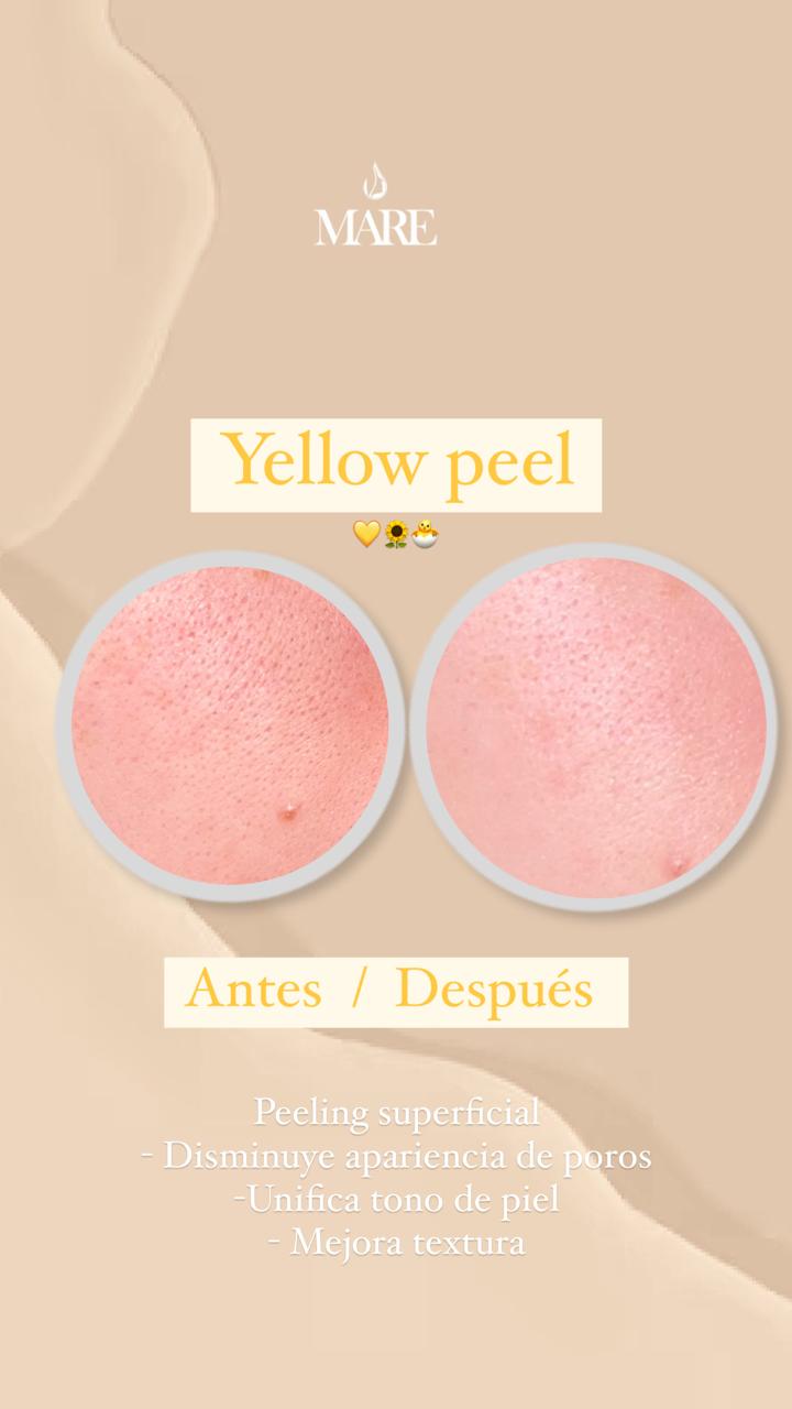 Yellow Peel Peeling Superficial