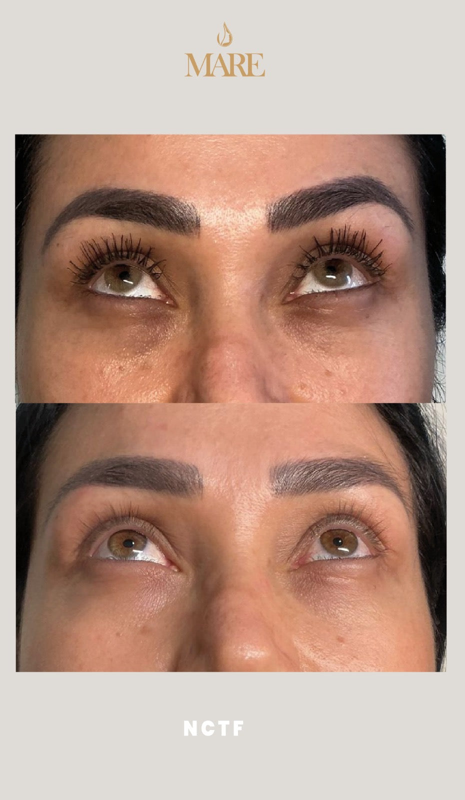 NCTF tratamiento revitalizante