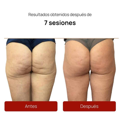 ALIDYA ANTICELULITIS