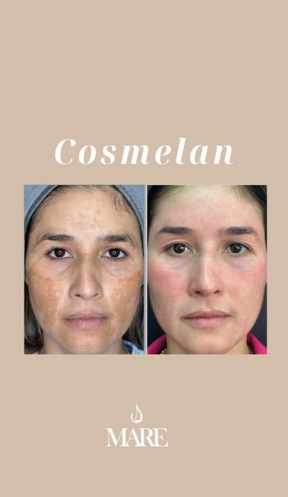 Cosmelan Tratamiento Despigmentante | Mare Perfect Skin