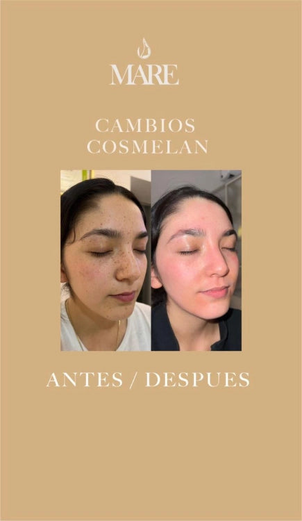 Cosmelan Tratamiento Despigmentante | Mare Perfect Skin