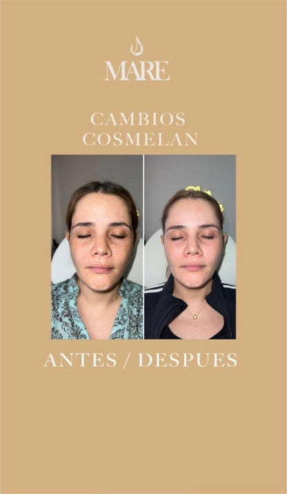 Cosmelan Tratamiento Despigmentante | Mare Perfect Skin