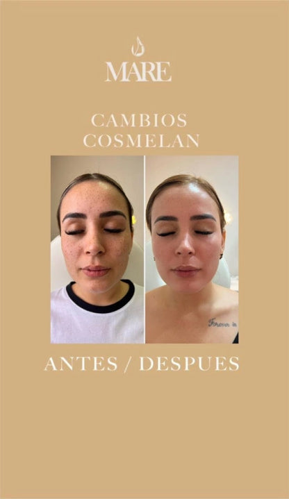 Cosmelan Tratamiento Despigmentante | Mare Perfect Skin