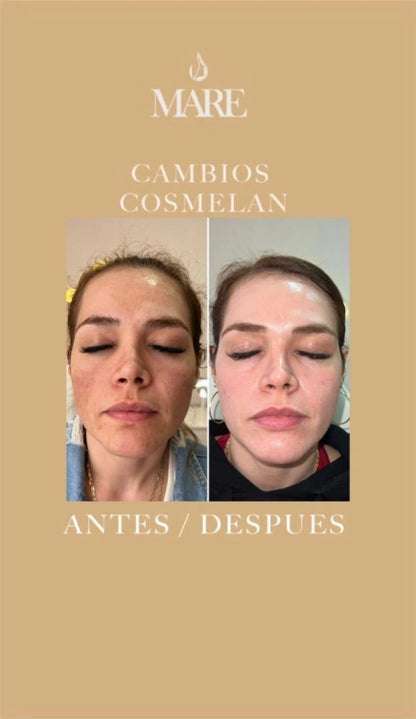 Cosmelan Tratamiento Despigmentante | Mare Perfect Skin