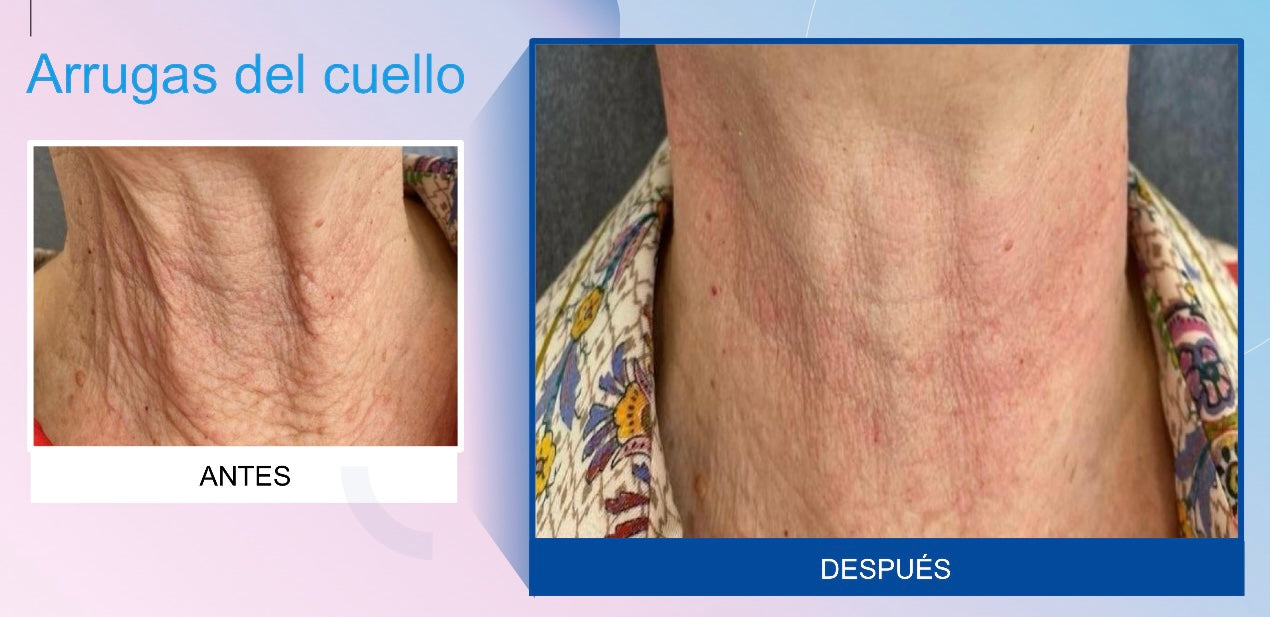 JUVELOOK BIOESTIMULADOR