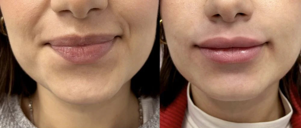 GLOSSY LIPS