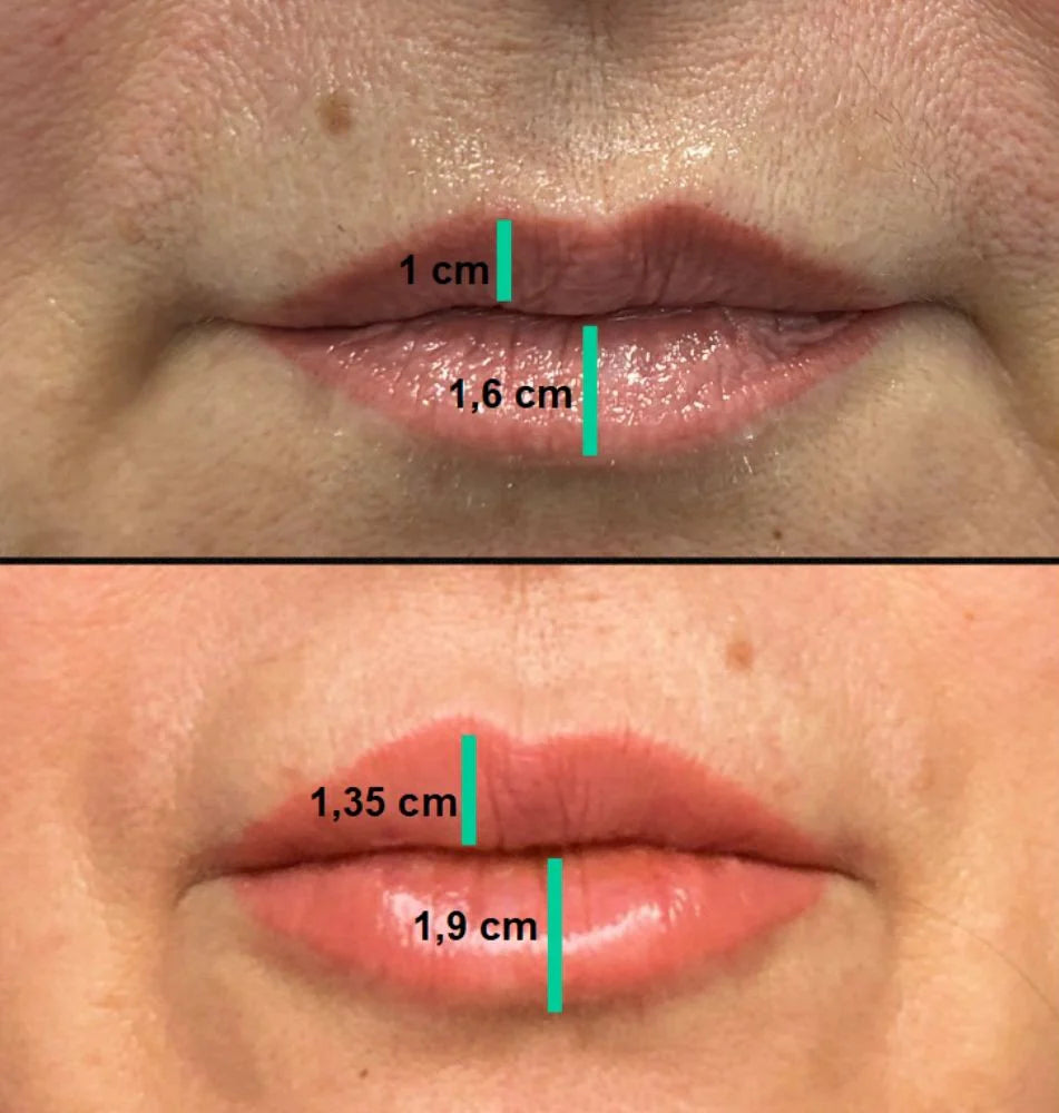 GLOSSY LIPS