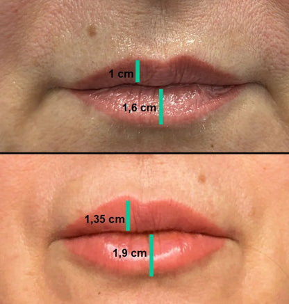 GLOSSY LIPS