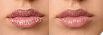GLOSSY LIPS