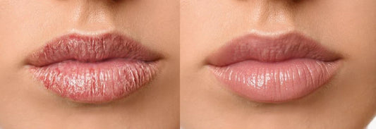 GLOSSY LIPS