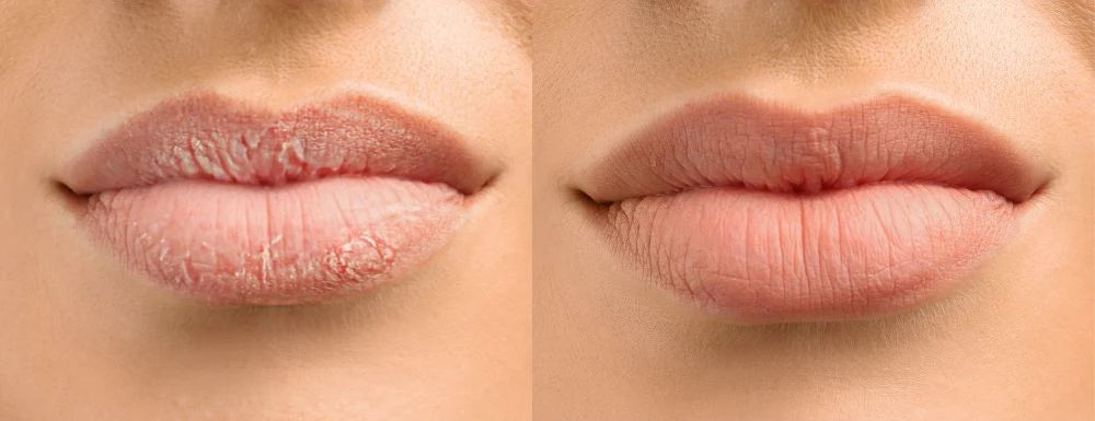 GLOSSY LIPS