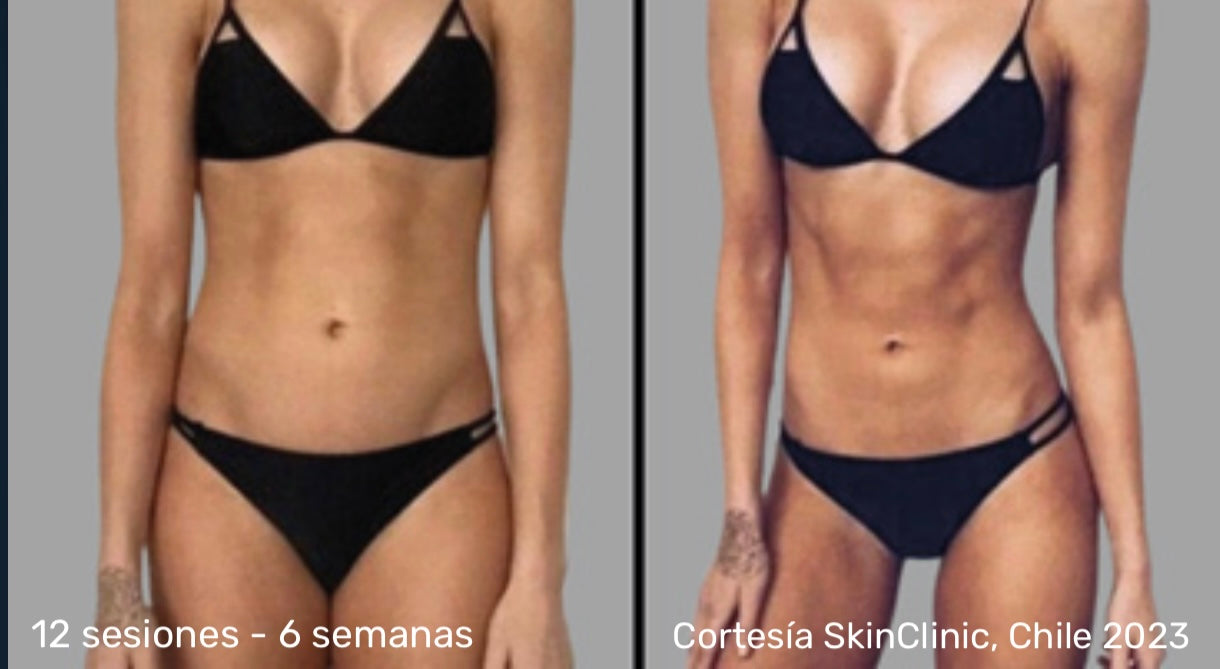 WONDER AXON – TONIFICACIÓN MUSCULAR Y REDUCCIÓN DE GRASA