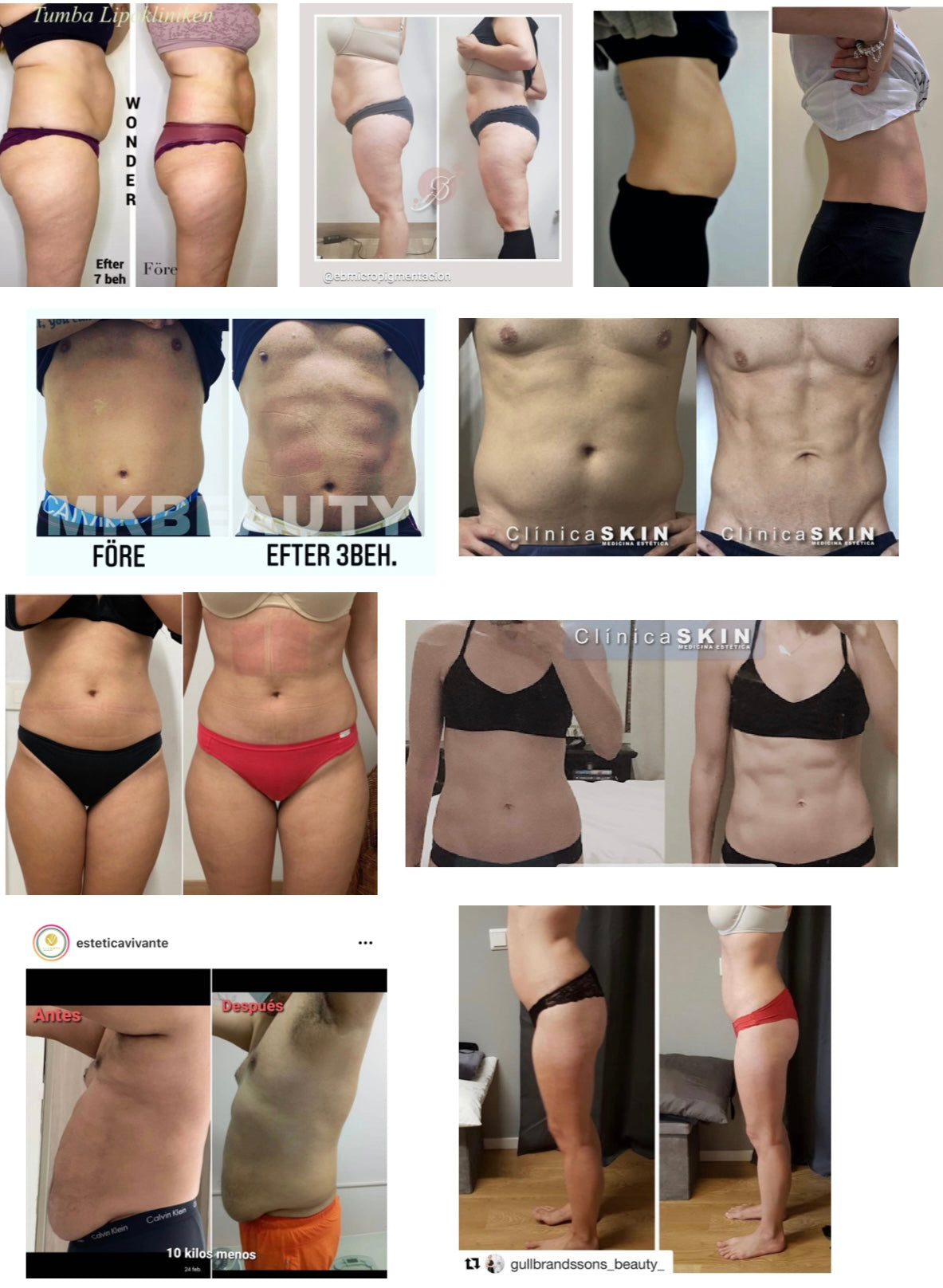 WONDER AXON – TONIFICACIÓN MUSCULAR Y REDUCCIÓN DE GRASA