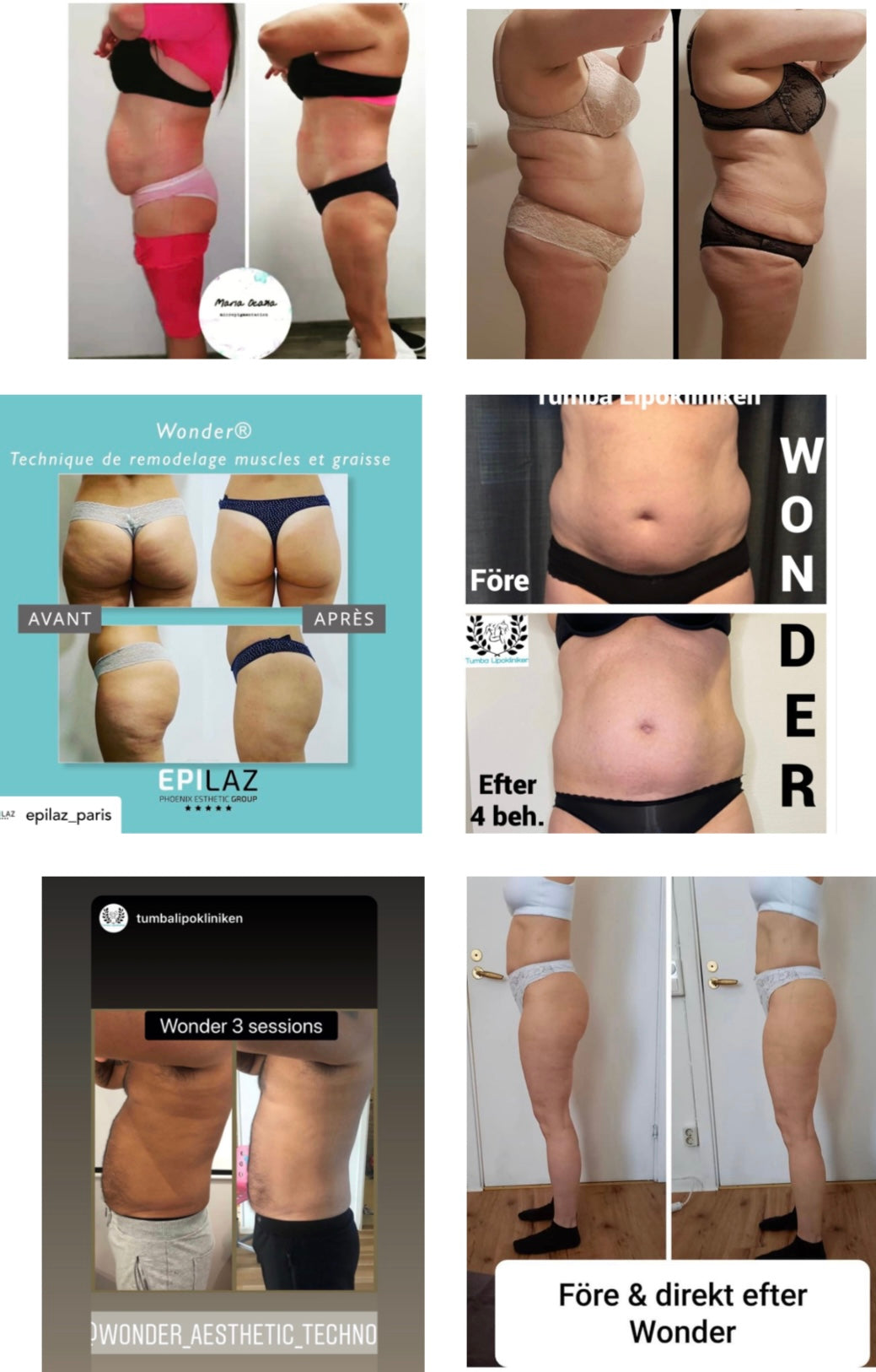 WONDER AXON – TONIFICACIÓN MUSCULAR Y REDUCCIÓN DE GRASA