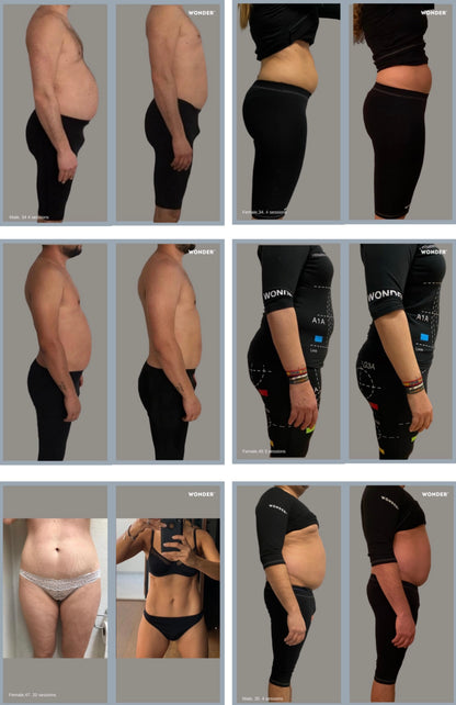WONDER AXON – TONIFICACIÓN MUSCULAR Y REDUCCIÓN DE GRASA