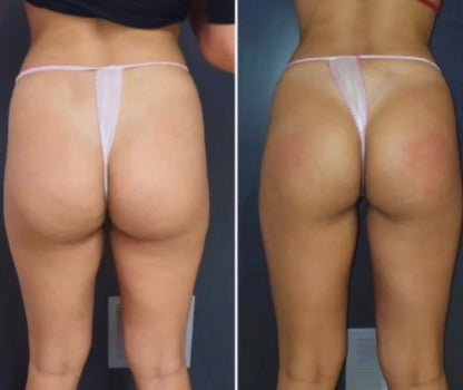 WONDER AXON – TONIFICACIÓN MUSCULAR Y REDUCCIÓN DE GRASA