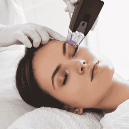 Morpheus8 – Rejuvenecimiento Facial y Corporal | Mare Perfect Skin