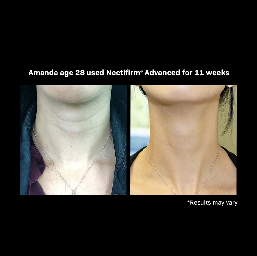 NectiFirm Advanced REVISION