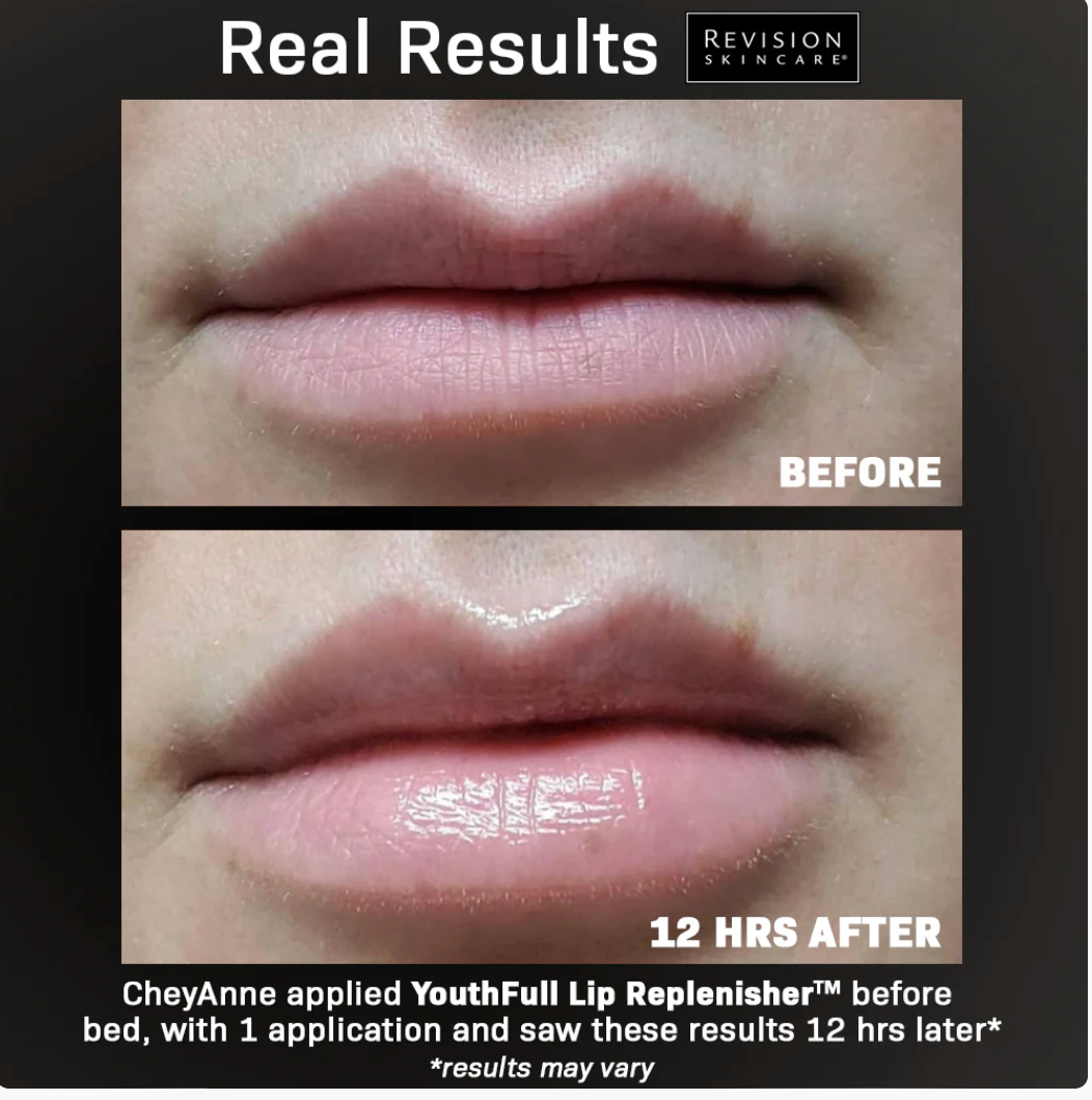 Youthfull lip replenisher Balsamo labial REVISION