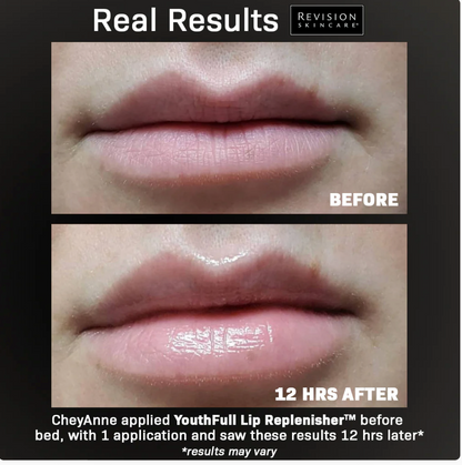 Youthfull lip replenisher Balsamo labial REVISION