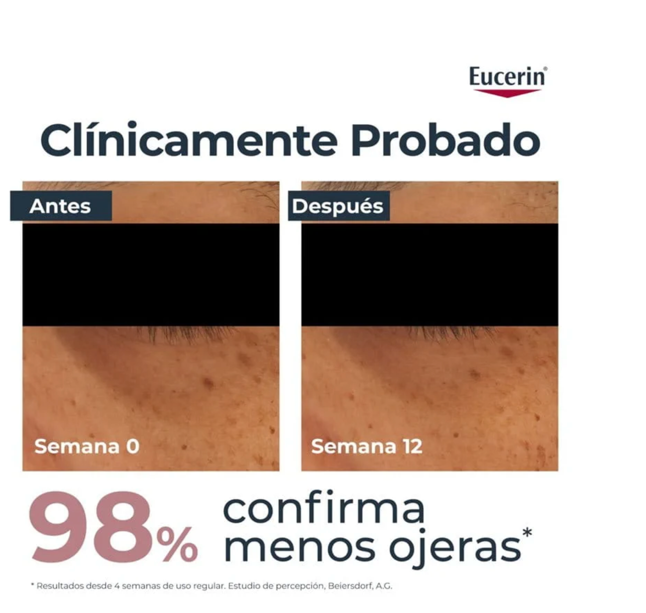 Anti Pigment Contorno de ojos Eucerin