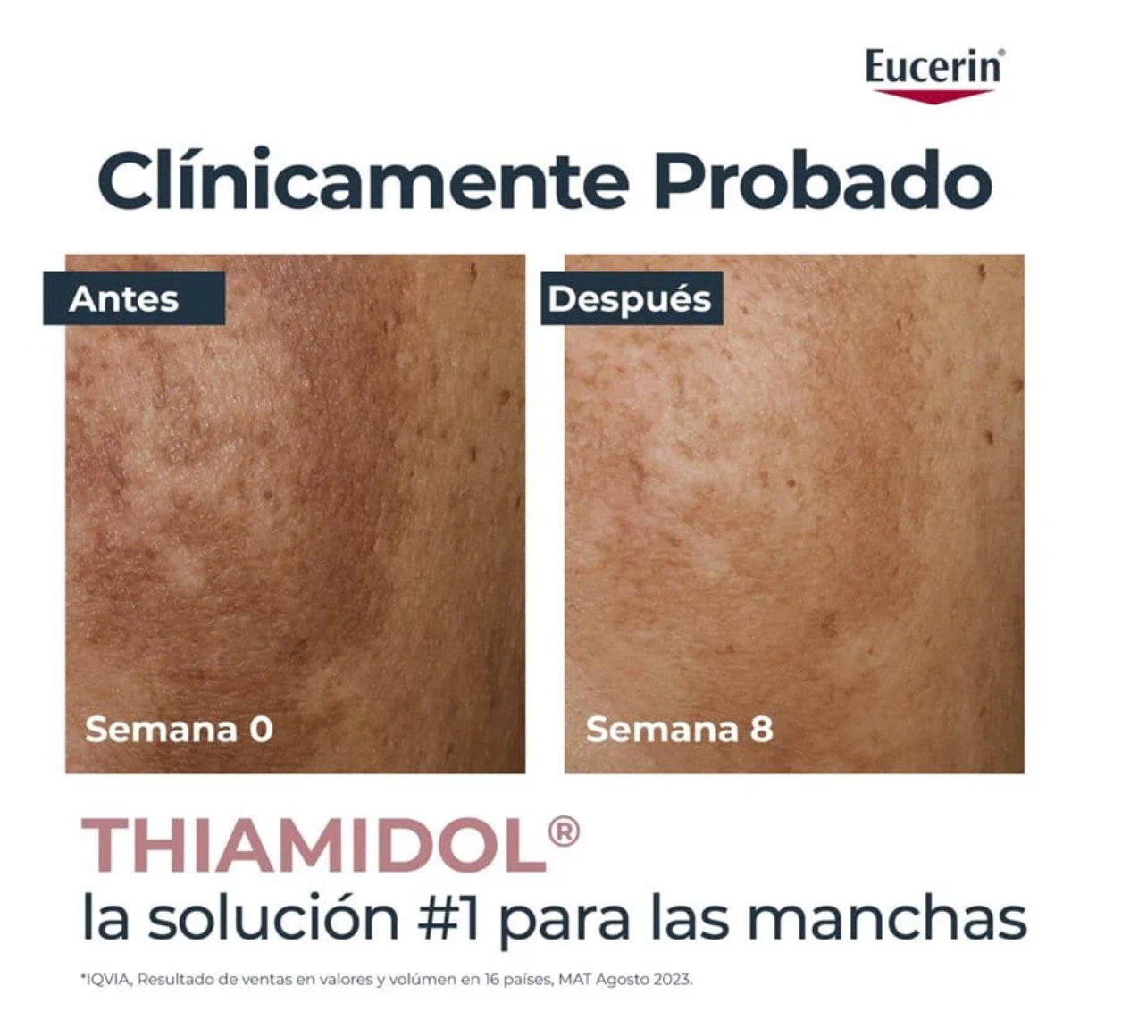 Anti Manchas Oily Skin Light Serum Eucerin