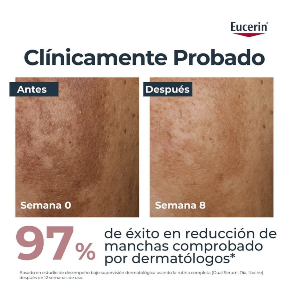 Anti Pigment Dual Serum Eucerin