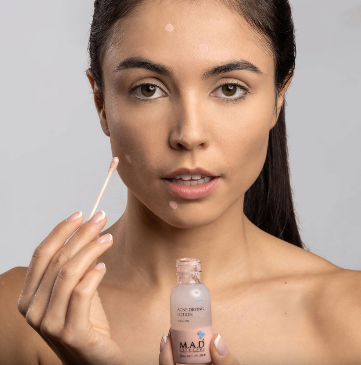 Acne Drying Lotion M.A.D