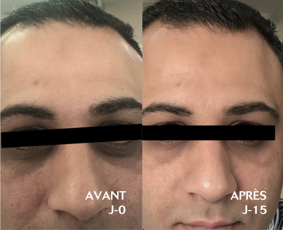 Eye Brightening Contorno de Ojos CEBELIA