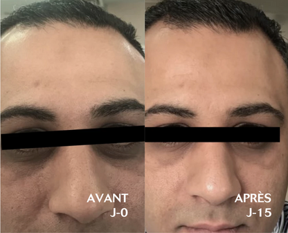 Eye Brightening Contorno de Ojos CEBELIA