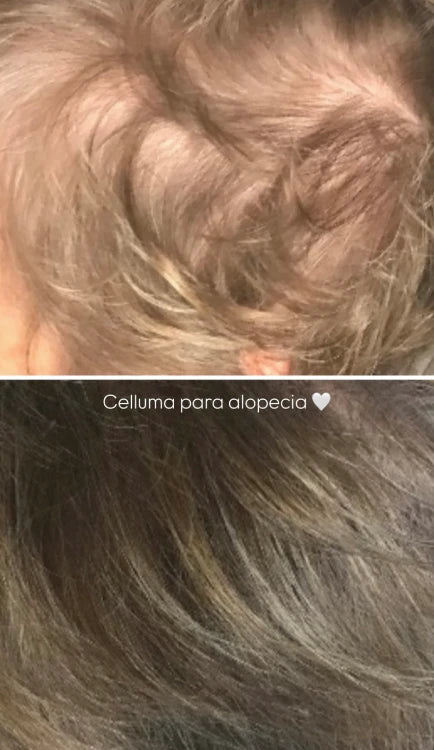 Terapia de Luz LED Celluma | Mare Perfect Skin