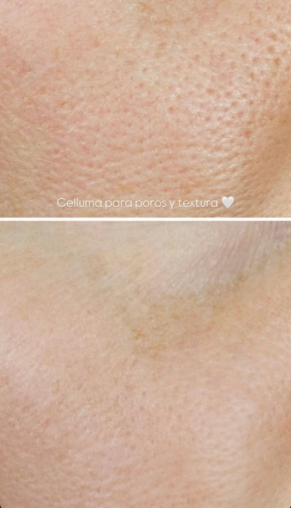 Terapia de Luz LED Celluma | Mare Perfect Skin