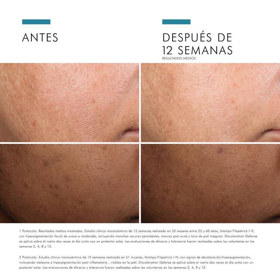 Discoloration Defense Skin Ceuticals