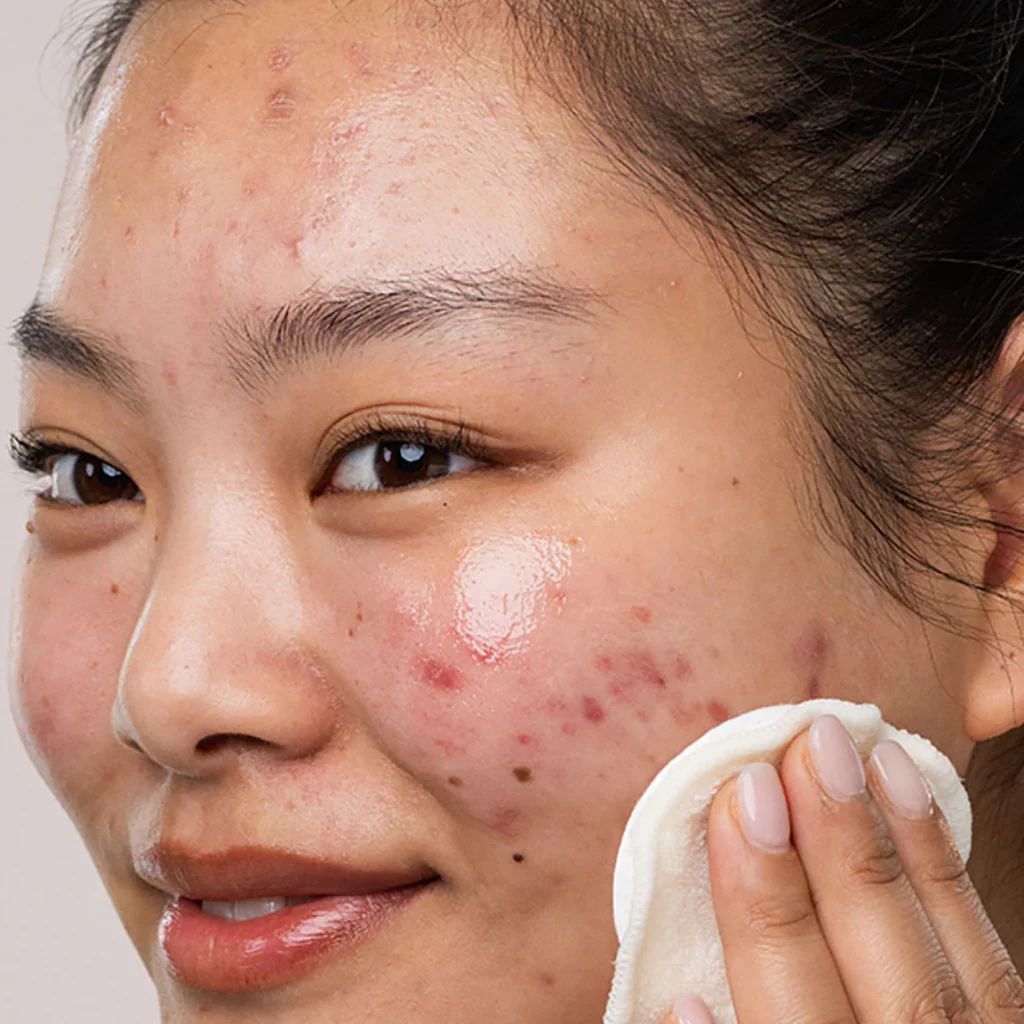 SVR Eau Micellaire SEBIACLEAR