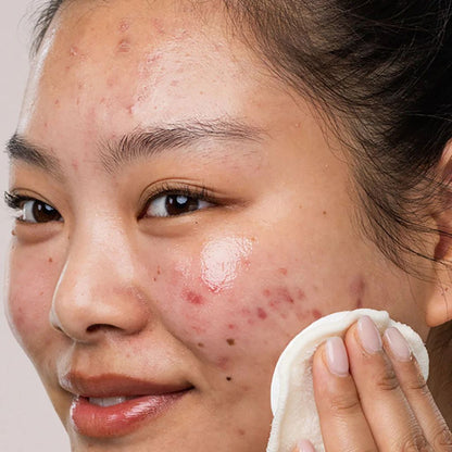 SVR Eau Micellaire SEBIACLEAR