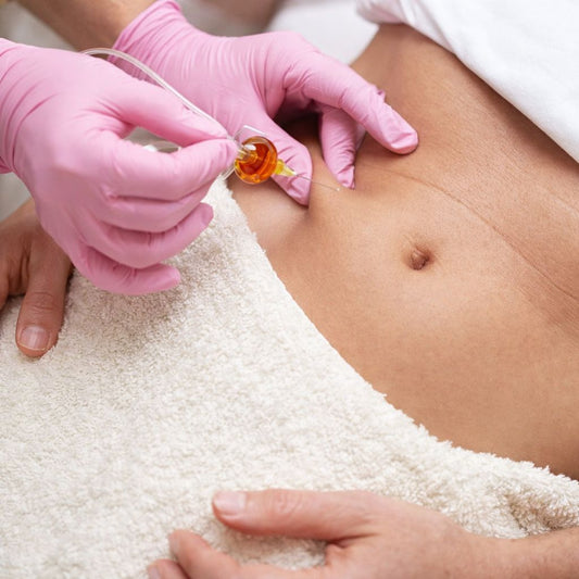 Carboxiterapia
