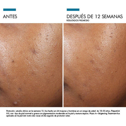 Phyto A+ Brightening Treatment Skin Ceuticals