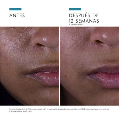 Silymarin CF