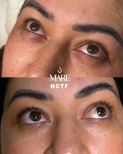 NCTF tratamiento revitalizante