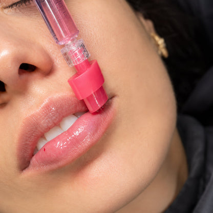 GLOSSY LIPS